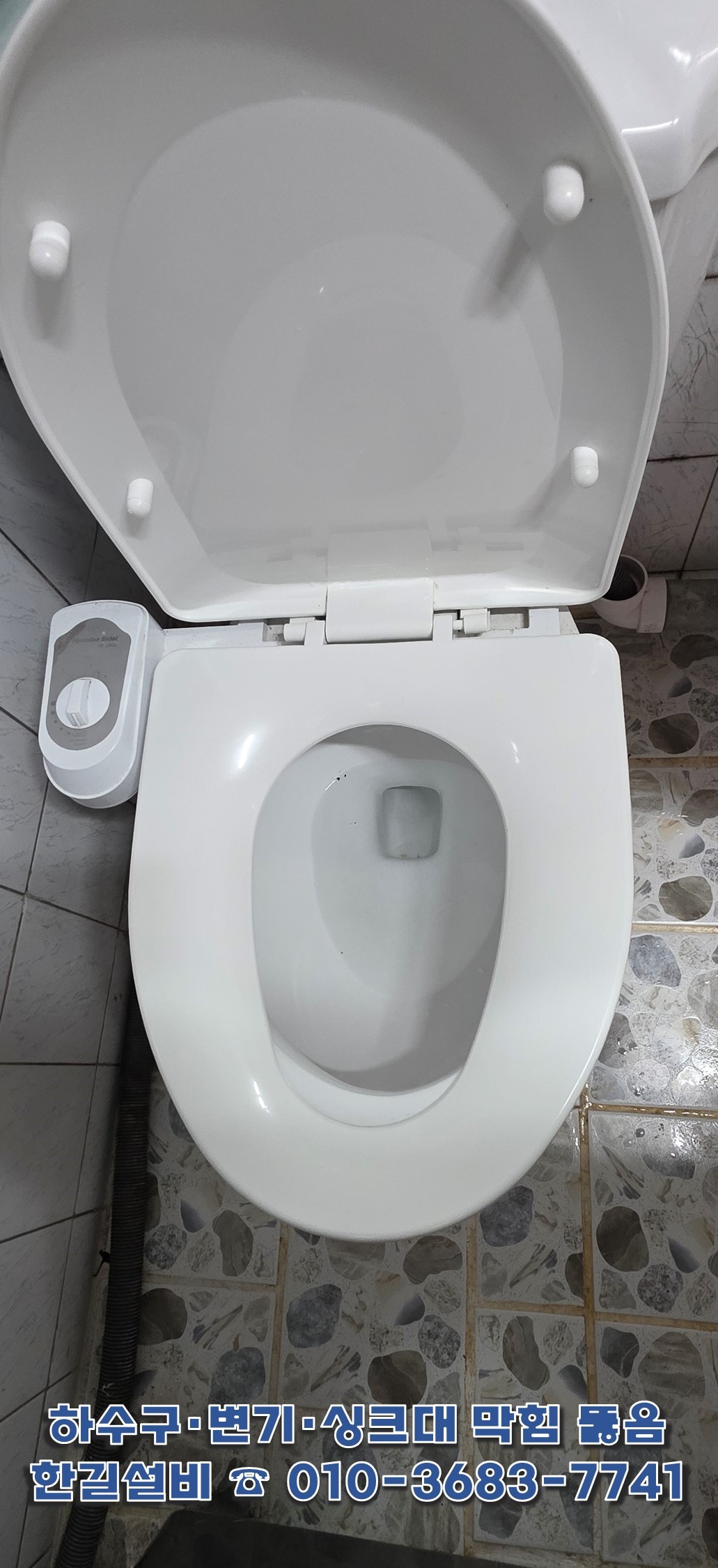 정상내려감상태